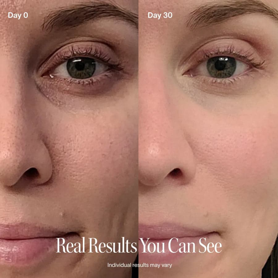 Day 0 vs Day 30